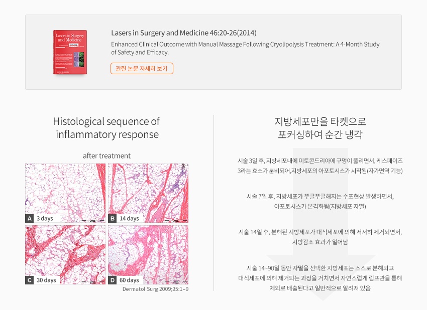 시술 후 시간별 조직학적 염증 반응 — Histological sequence of inflammatory response (3, 14, 30, 60 days)